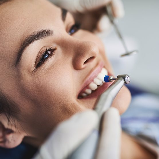 Dental patient getting a professional teeth cleaning