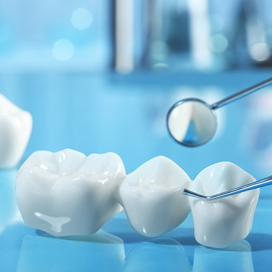 Dental bridge on a table next to a dental mirror