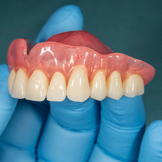 Gloved hand holding a full denture