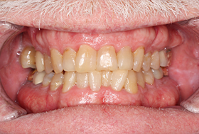 Close up of a man with yellowed teeth