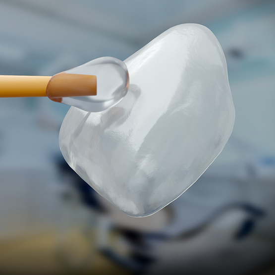 Bonding material being applied to a veneer